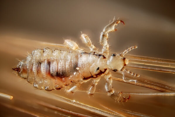 Home Remedies for Head Lice