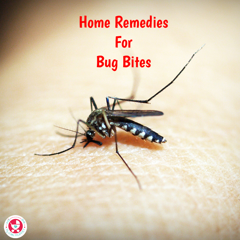 8 Effective Home Remedies for Bug Bites