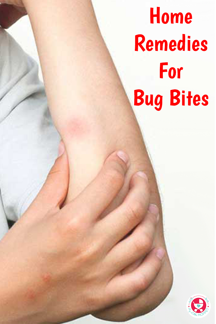Don't scratch that itch! Here are 8 effective home remedies for bug bites to get rid of the irritation without any harmful side effects.