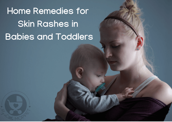 Seeing a rash pop up on your baby's delicate skin can be distressing for you and your baby. Here is a guide to deal with skin rashes in babies and toddlers.