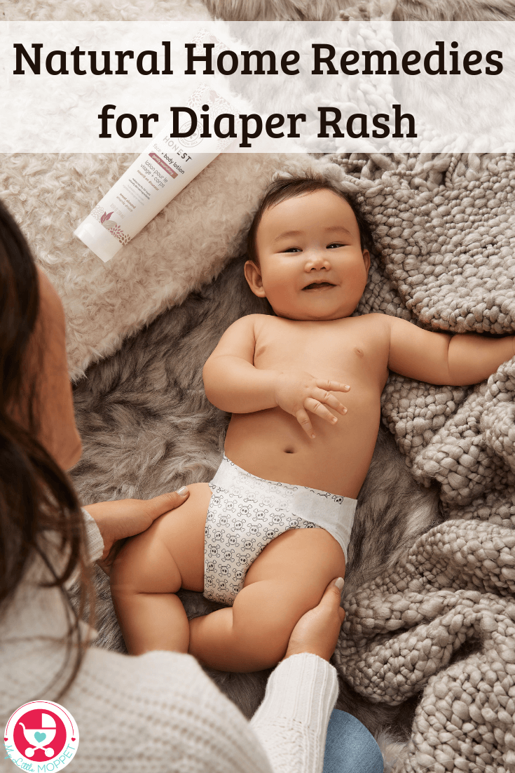 Diaper rash can range from mild to severe, but it can extremely painful for infants. Tackle it the natural way with these Home Remedies for Diaper Rash.