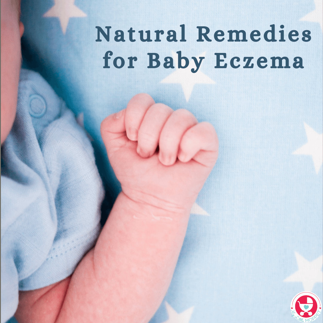 If you're struggling with baby eczema, you're not alone. Here are 12 natural home remedies for Baby Eczema that have worked for other parents like you.
